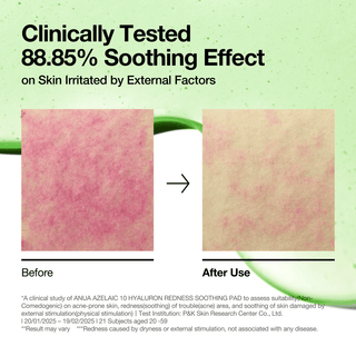 [Anua] Azelaic 10 Hyaluron Redness Soothing Pad 230ml 90ea - Diva Melody