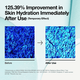 [anua] PDRN 100 Hyaluronic Acid Glow Pad 180ml 60ea - Diva Melody