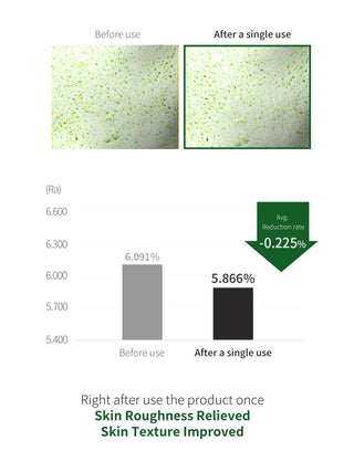 [Benton] Aloe BHA Skin Toner 200ml - Renewal - Diva Melody