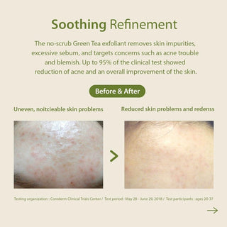 [Blithe] Patting Splash Mask Soothing & Healing Green Tea 150ml - Diva Melody