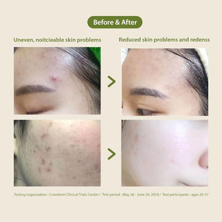 [Blithe] Patting Splash Mask Soothing & Healing Green Tea 150ml - Diva Melody