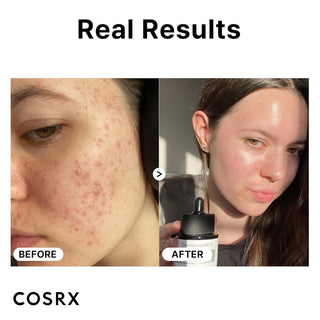 [Cosrx] The Niacinamide 15 Serum 20ml - Diva Melody