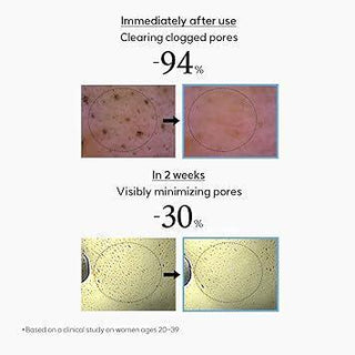 [Hanyul] Chestnut Shell Pore Clearing Clay Mask 100ml - Diva Melody