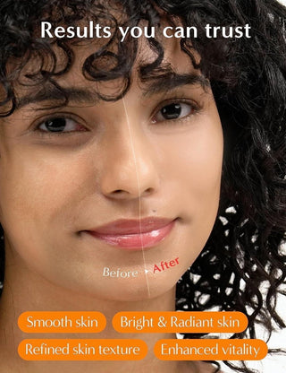 [It'sSKIN] Power 10 Formula YE Effector 30ml - Diva Melody