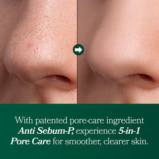 [Omitted] Fresh Lime Glow & Pore Refining Serum 50ml - Diva Melody