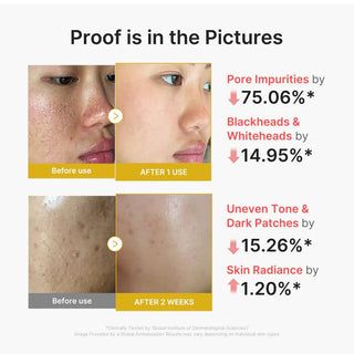 [Medicube] Kojic Acid Turmeric Peel Shot 80ml