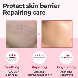 [SomeByMi] SNAIL TRUECICA MIRACLE REPAIR SERUM 50ml - Diva Melody