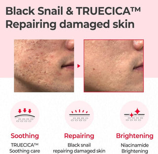 [SomeByMi] SNAIL TRUECICA MIRACLE REPAIR TONER 150ml - Diva Melody